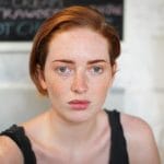 Causes of Acne in Young Girls.jpg